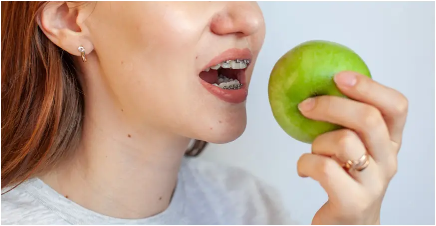 Can You Eat Apples With Braces?